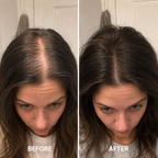 Deoxyribose Hair Serum